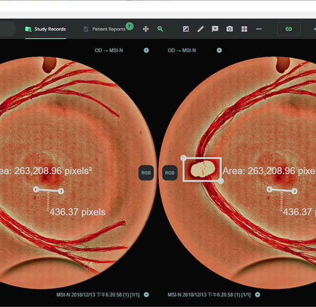 DragonVision-MSI-Software